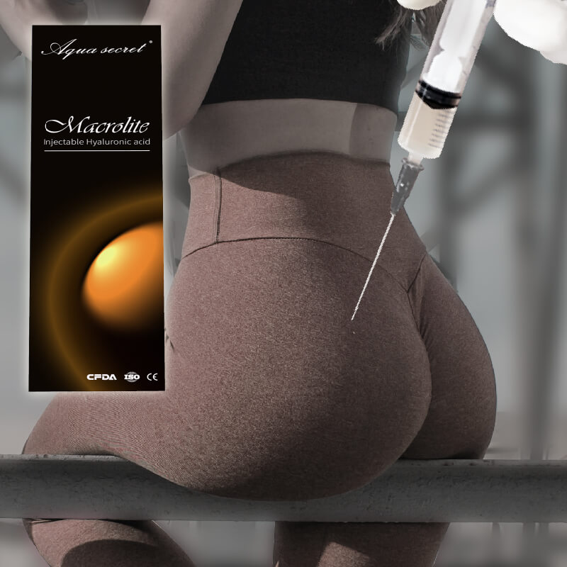 ¿Cuánto Cuesta El Ácido Hialurónico En Glúteos?