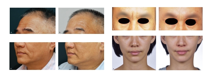 Nutriderm hidrato skin reforzador para ojo