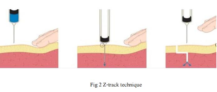 como se inyecta el acido hialuronico en gluteos