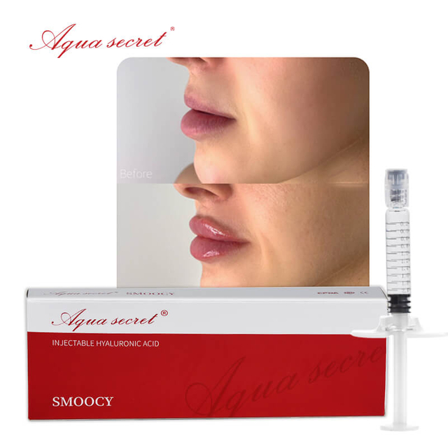 ¿Cuál Es La Mejor Marca Para Relleno De Labios?