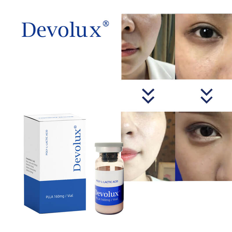 Devolux® Inyección de Ácido Poli-L-Láctico