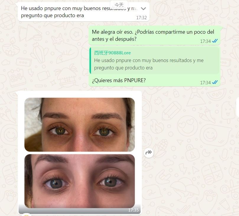pn反馈.jpg