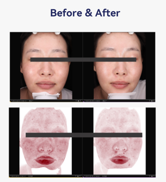 potenciador de piel pdrn