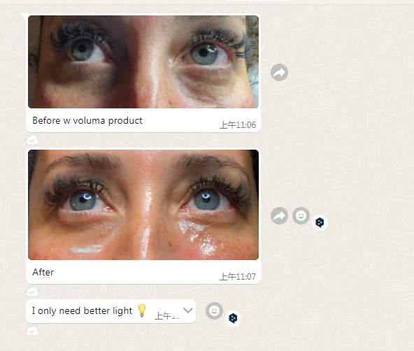 tratamientos con polinucle&oacute;tidos est&eacute;ticos