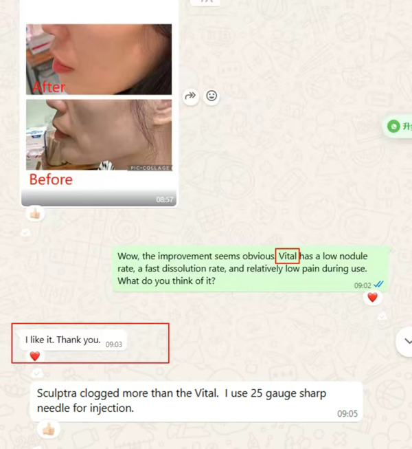 &aacute;cido polil&aacute;ctico antes y despu&eacute;s