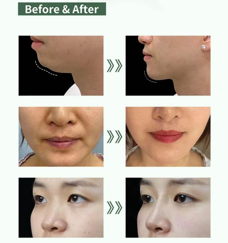 que es el polimetilmetacrilato pmma