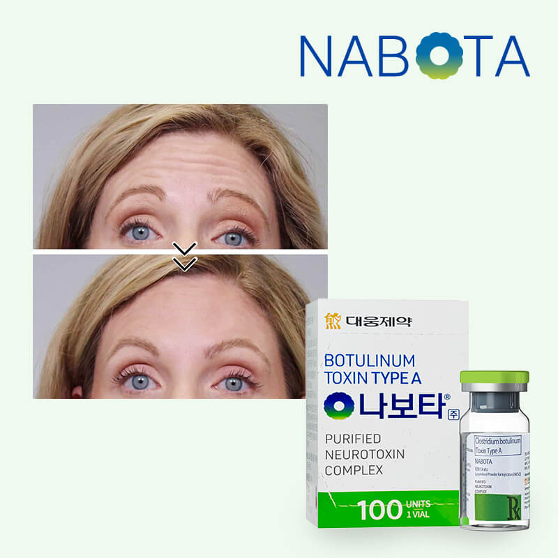 Comprar Nabota 100 Unidades