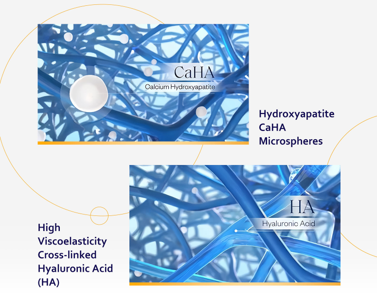 Diferencias entre Ácido Hialurónico e Hidroxiapatita Cálcica