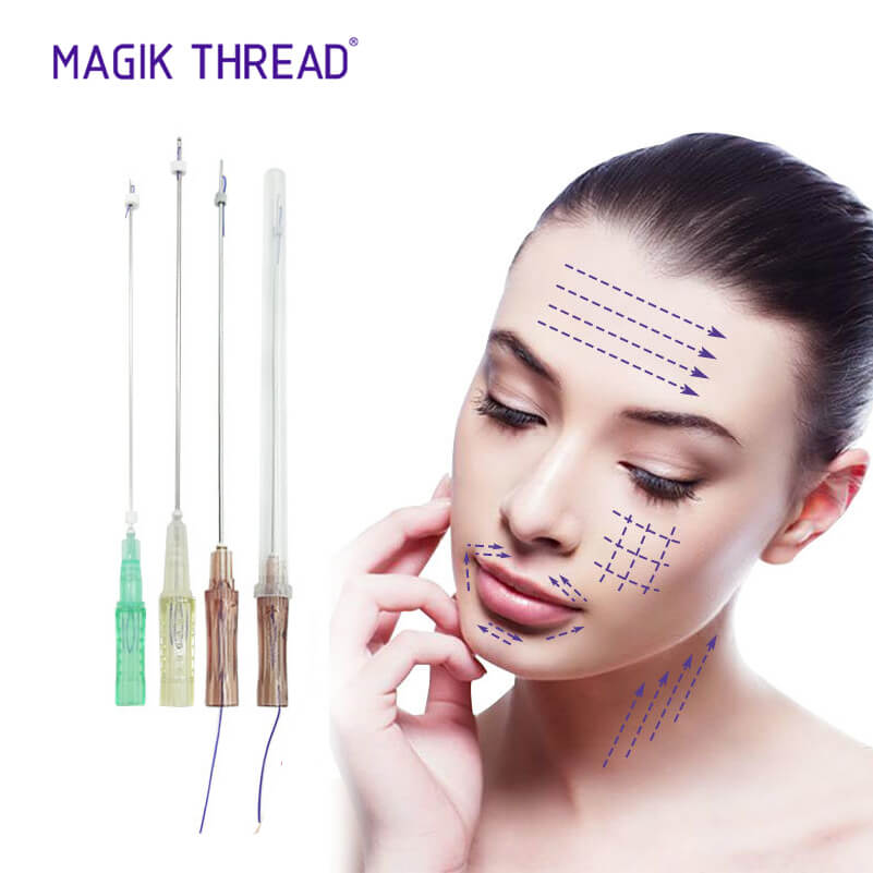 que son los hilos tensores de pdo